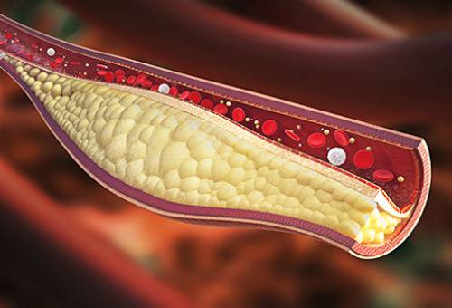 This Blood Test Can Save Your Life